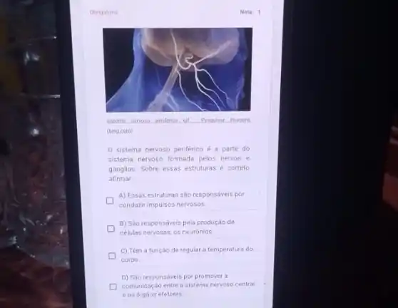 Obrigatoria
Nota: 1
sistema nervoso penferico of Pesquisar magens
(bing.com)
0 sistema nervoso periférico é a parte do
sistema nervoso formada pelos nervos e
gãnglios. Sobre essas estruturas é correto
afirmar:
A) Essas estruturas são responsáveis por
conduzir impulsos nervosos.
B) São responsáveis pela produção de
células nervosas, os neurónlos.
C) Têm a função de regular a temperatura do
corpo
D) Sáo responsáveis por promover a
comunicação entre o sistema nervoso central
e os orgáos efetores.