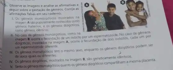 5. Observe as imagens e analise as afirmativas a
seguir sobre a gestação de gêmeos. Corrija as
afirmações falsas em seu caderno.
I. Os gêmeos monozigóticos mostrados na
imagem A sào conhecidos como
gemeos fraternos, e os gêmeos dizigóticos,
como gêmeos idênticos.
II. No caso de gêmeos monozigóticos, como na imagem B, ocorre a um ovócito por um espermatozoide. No caso de gemeos
dizigóticos, mostrados na imagem A, ocorre a fecundação de dois ovócitos, cada um por
um espermatozoide diferente.
III. Os gêmeos monozigóticos têm o mesmo sexo enquanto os gêmeos dizigóticos podem ser
de sexos iguais ou diferentes.
IV.
Os gêmeos dizigóticos mostrados na imagem B são geneticamente idênticos.
V.
Tanto os gêmeos monozigóticos quanto os gêmeos dizigóticos compartilham a mesma placenta.