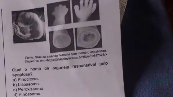 Disponivel em:-https ://slideplayer.com
Qual o nome da organela responsável pelo
apoptose?
a) Pinocitose.
b) Lisossomo.
c) Peroxissomo.
d) Pinossomo.