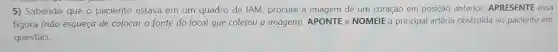 5) Sabendo que o paciente estava em um quadro de IAM procure a imagem de um coração em posição anterior, APRESENTE essa
figura (não esqueça de colocar a fonte do local que coletou a imagem), APONTE e NOMEIE a principal artéria obstruída no paciente em
questão.