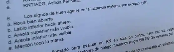 6.
Los signos de buen agarre en la lactancia materna son excepto: (1P)
a. Boca bien abierta
hacia afuera
b. Areola superior más visible
c. Araola inferior más visible
d. Arenton toca la mama
d
RNT/AEG, Asfixia Perinatal.
e.
llamado para evaluar un RN energi de partos,nace ra evalus de riesgo maternos dengang EG: 36 semanas