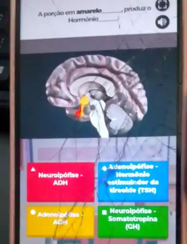 A porção em amarelo __ produx o
Hormônio __
Neuroipófise -
reaux
estimulation
Adenoipé fise
Neurolpofise
Somatotropina
GH