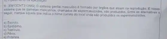 6- (EM13CNT313MG) 0 sistema genital masculino é formado por órgãos que atuam na reprodução.
E nesse
sistema que os gametas masculinos, chamados de espermat zoides, sáo produzidos. Entre as alternatives a
seguir, marque aquela que indica o nome correto do local onde são produzidos os espermatozoides.
a)Escroto
b) Epid(dimo.
C)Testiculo.
d) Pênis.
e) Próstata.