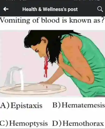 Health &Wellness's ; post
Vomiting of blood is known as?
A ) Epistaxis B ) Hematemesis
C)Hemoptysis D)Hemothorax